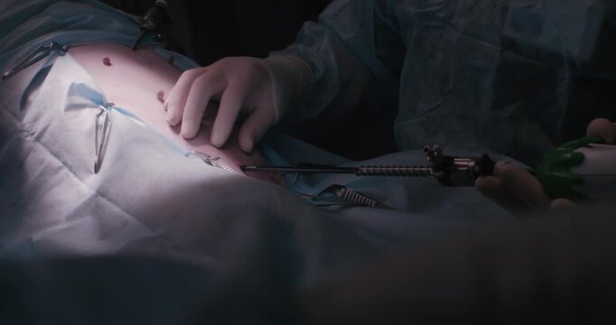 Endoscopic surgery on a pet in veterinary surgery. A surgeon operates endoscopically on a dog under anesthesia in veterinary surgery. Veterinary endoscopy concept.