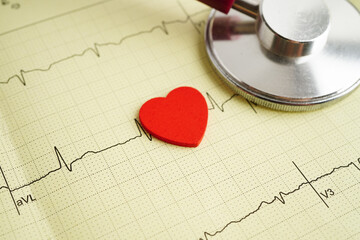 Electrocardiogram (ECG), heart wave, heart attack, cardiogram report.