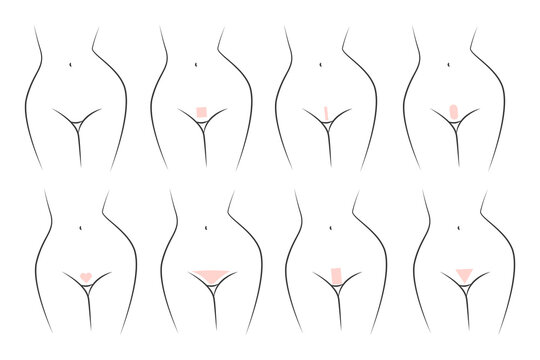 Bikini area hair removal in different styles. Haircuts zone bikini, wax depilation styles.