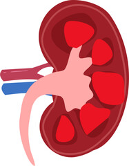 Obraz premium Kidney disease Illustration