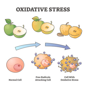 Oxidative stress aging as free radical cell attack process outline diagram, transparent background. Skin disease with chronic molecular destruction illustration.