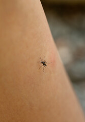 Tiger mosquito bites a man's leg. Defocused