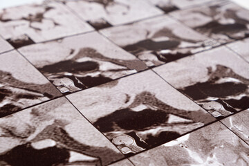 Magnetic resonance imaging of the head of a healthy person, image of the pituitary gland.