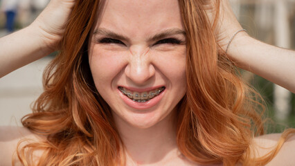 Fototapeta premium Close-up portrait of a young red-haired woman with braces on her teeth. Girl makes faces at the camera outdoors. 