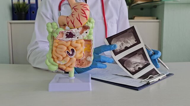 Doctor examines digestive system model and ultrasound image. Stomach intestine ulcers cyst and oncology and examination