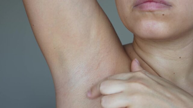 Young caucasian woman showing small papillomas under her armpit on a dark grey background. Human papilloma virus