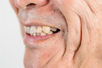 Obraz premium シニアのおじいさんの口元のアップ（インプラント・歯周病・入れ歯・審美歯科・歯科治療）