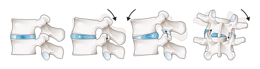 The mobility of the lumbar vertebrae. Facet joint. Medical illustration.