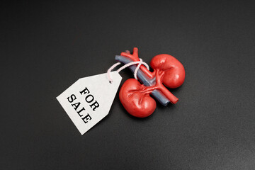Model Kidney With For Sale Tag On Black Surface