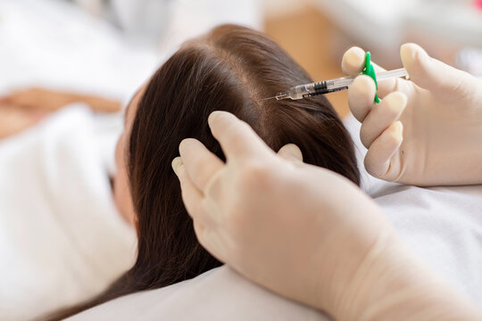 Beautician injections for healthy hair growth. Mesotherapy of the scalp. Woman undergoing course of spa treatments in the office of beautician