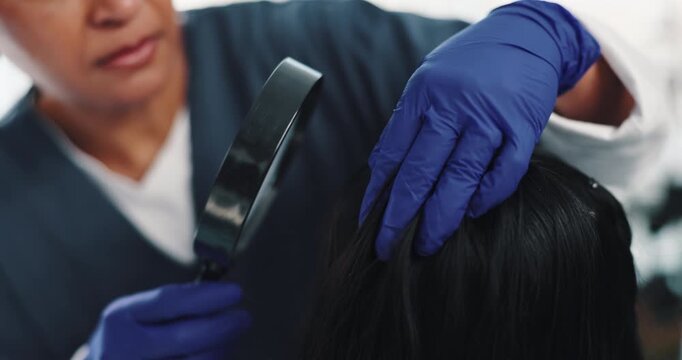 Magnifying glass, woman and doctor with hair, diagnosis and haircare for patient and consultation in clinic. Texture, lice and burning of scalp, hand and inspection of infection by trichologist