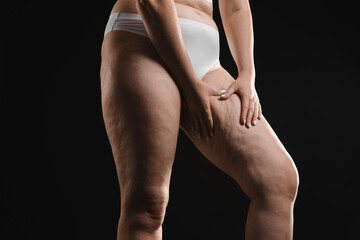 Woman with cellulite on black background, closeup