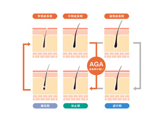AGAヘアサイクルフチなしカラー