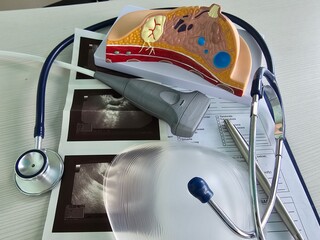 Explains disease and uses anatomical model of breast. Examination of breast ultrasound after...