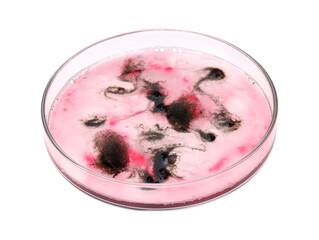 Petri dish with bacteria isolated on white
