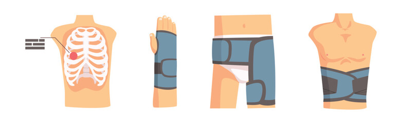 Human Bone and Joint Fracture and Rehabilitation Object Vector Set