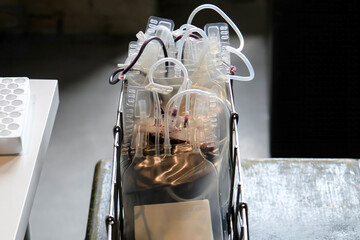 Containers with donated blood at a blood donation point in Kyiv, Ukraine June 11, 2024