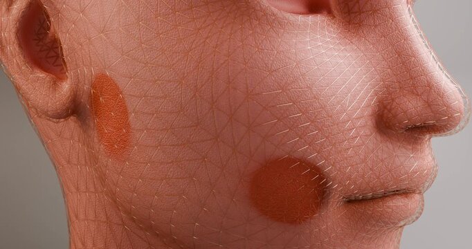 3D animation has a pinpoint effect on the skin of the face. The effects of exposure to ultraviolet rays from the sun, such as damage, sunburn, redness, and darkening of the skin, can cause dermatologi