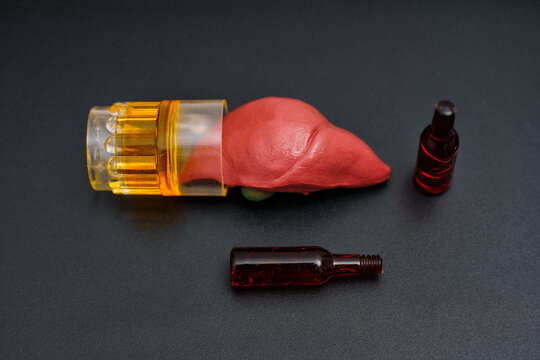 Visual Representation of Alcohol's Impact on Liver Health - Powered by Adobe