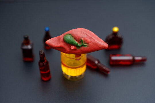 Educational Display of Liver Model with Alcohol Bottles on Black