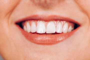 Close up portrait of smiling unrecognizable woman with perfect teeth. Smiling young girl, beautiful mouth.

