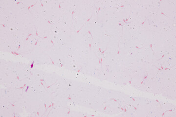 Anatomy and Histological Uterine tube, Uterus, Vagina, Ovary and Testis Rabbit cells under microscope.