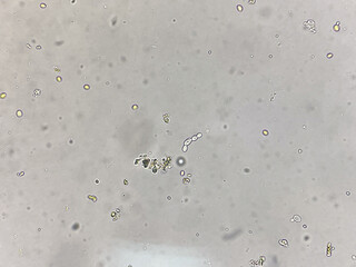 Yeast cell