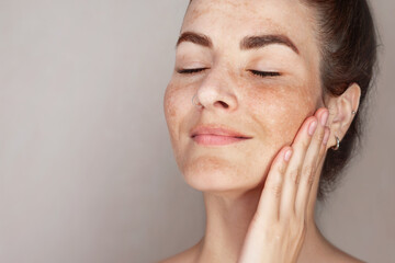 Caucasian woman's face with freckles or age spots, melasma, she loves her skin