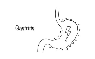 Gastritis