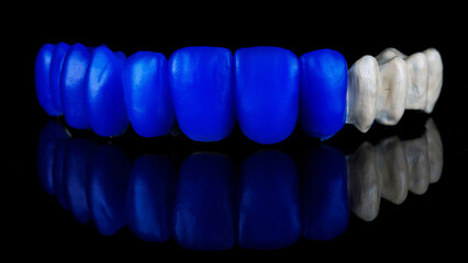 perfect wax-up of the teeth of the upper jaw on a bar of titanium on black glass with reflection © Dental Pro Content