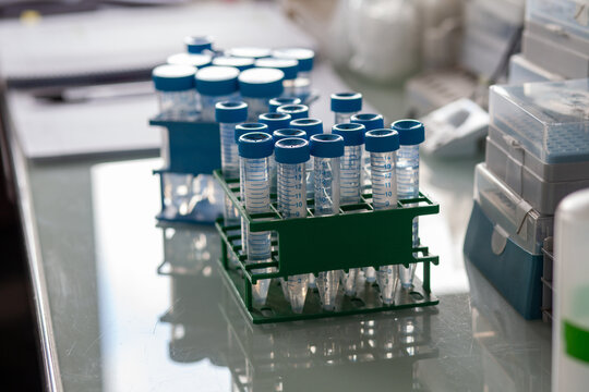 testing tubes on a glass table in scientific laboratory, close up