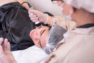 Example of radio frequency facial done on a male patient. RF skin tightening procedures.