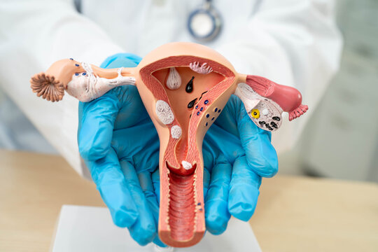 Uterus, doctor with anatomy model for study diagnosis and treatment in hospital.