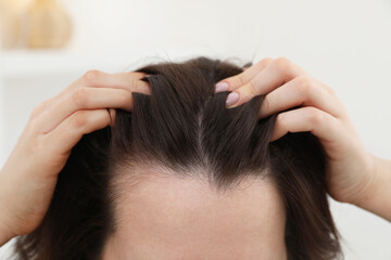 Naklejka premium Woman with hair loss problem at home, closeup