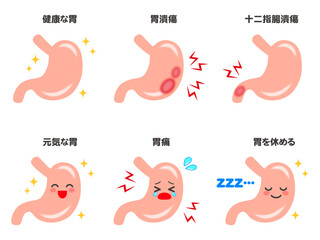 綺麗な胃腸と十二指腸潰瘍と胃潰瘍のイラスト素材セット