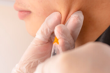 Masseter Jaw masseter botulinum toxin injection, also known as Jawtox procedure.