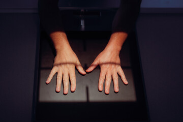 Hands of a Patient on a Radiology Table with Lights On. Adult person being checked for trauma or...