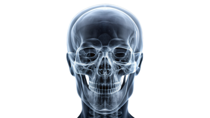 An X-ray image showing a detailed view of a human skull and head with anatomical features and medical details