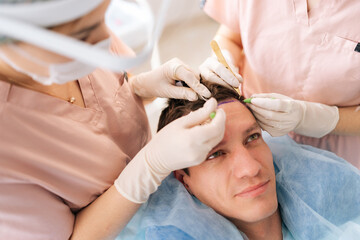 High-angle view of trichologist surgeons carry out hair transplant surgery in operating room to male patient with hairloss problem. Surgical technique that moves hair follicles from part of head.