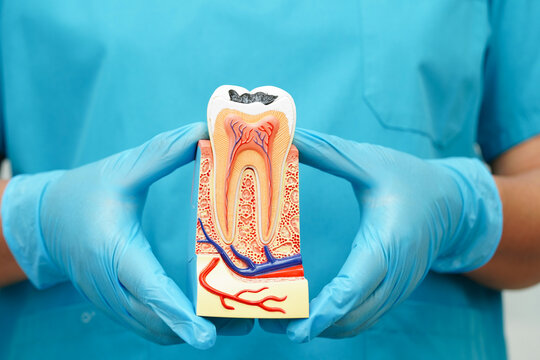 Dentist holding dental implant, artificial tooth roots into jaw, root canal of dental treatment, gum disease, teeth model for dentist.