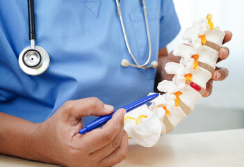 Asian doctor holding spinal nerve and bone model, Lumbar spine displaced herniated disc fragment...