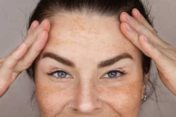 Caucasian woman's face with freckles or age spots, melasma. she is smiling, cropped, close up