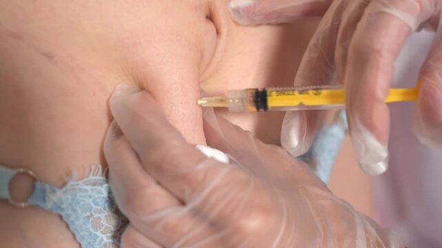 Vertical shot of lipolytics injection under the skin with a needle. close-up injections in the stomach. weight loss procedure. anti-aging procedures. doctor's hands in gloves. beauty.cosmetology