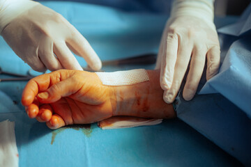 Doctor Applying a Bandage over the Fresh Surgical Operation. Surgeon giving post operator...