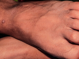 Naklejka premium Male feet with clean white nails with brown skin color