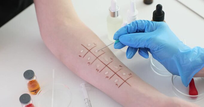 Skin prick test for allergies in the clinic