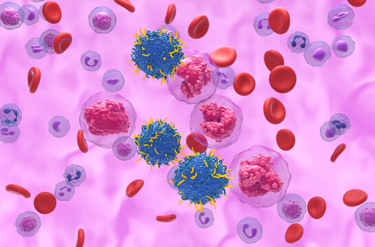 CAR T cell therapy in Acute Lymphocytic Leukemia (ALL) - isometric view 3d illustration