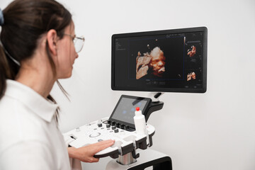 Sonographer analyzing ultrasound images on monitor
