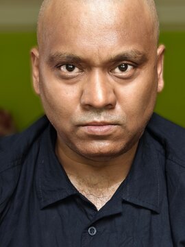 A bald headed man with angry facial expression