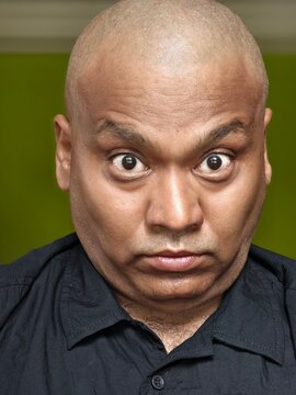 A bald headed man with angry facial expression